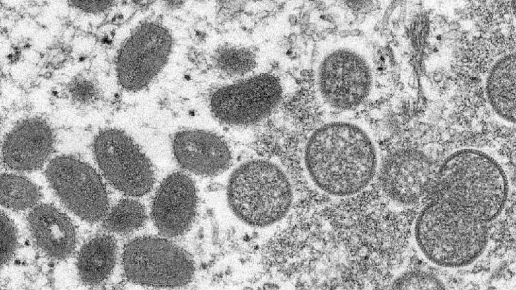 South Africa confirms third case of monkeypox - CGTN