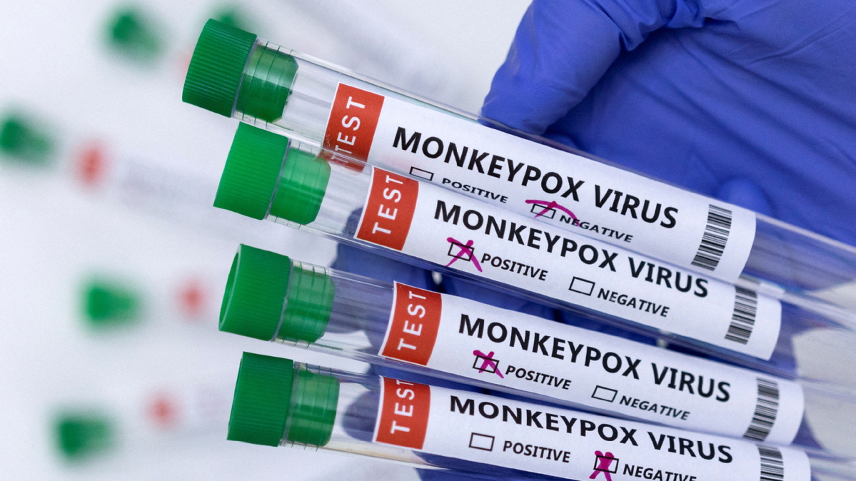 Monkeypox virus test samples. /AP