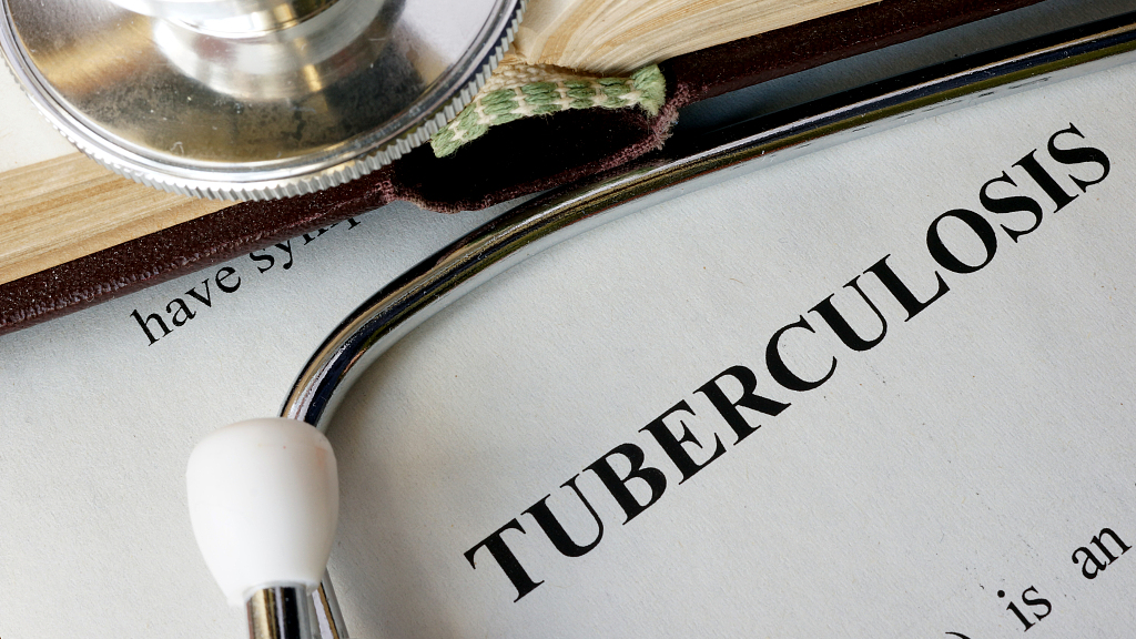 Tuberculosis (TB) infections in Tanzania have reduced by 32 percent. /CFP photo  