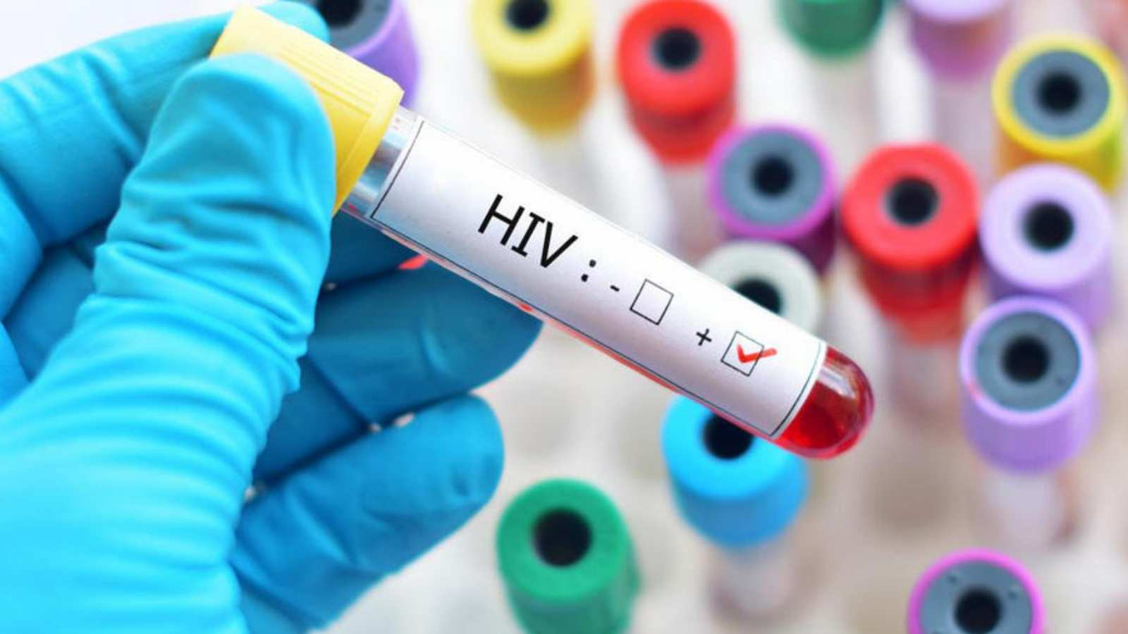 Rwanda has significantly reduced HIV-related stigma, discrimination and abuse of rights of people living with the virus. /Getty Images