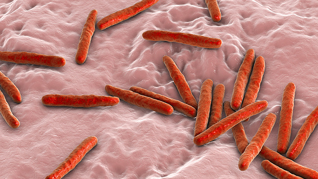 Diagram of Mycobacterium tuberculosis (TB). /CFP
