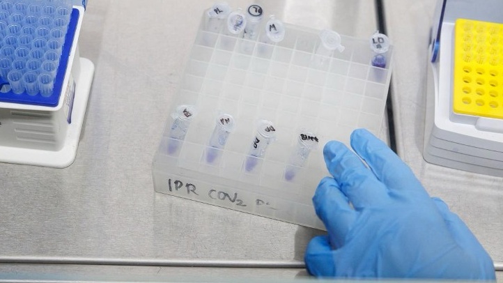 A graduate student from the Kenya Institute of Primate Research (KIPRE) prepares venom samples for analysis during research to develop effective antivenom therapies to counter the often deadly effects on victims of snake bites in Nairobi on February 28, 2025./CFP