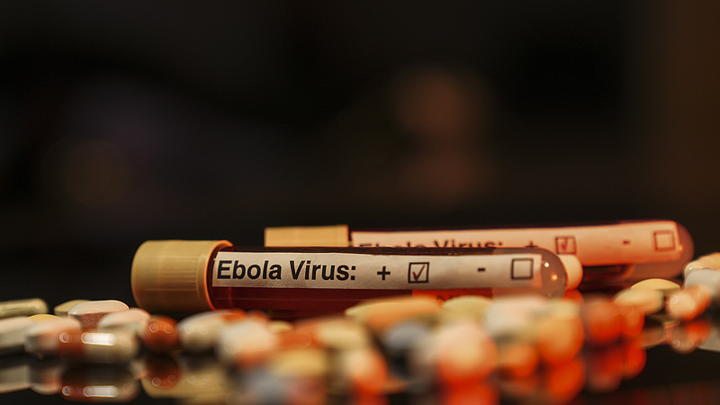 This photo illustration depicts the Ebola virus. /CFP