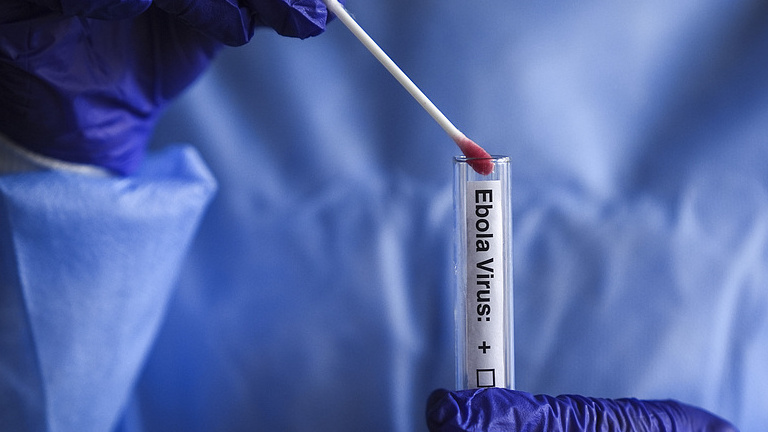 Microscopic images of the Ebola virus, May 24, 2026. /CFP