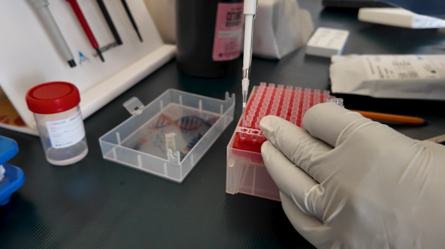 Cervical cancer samples being tested at the laboratory at the Matibabu Foundation Hospital in Kenya, February 26, 2026. /CGTN Africa