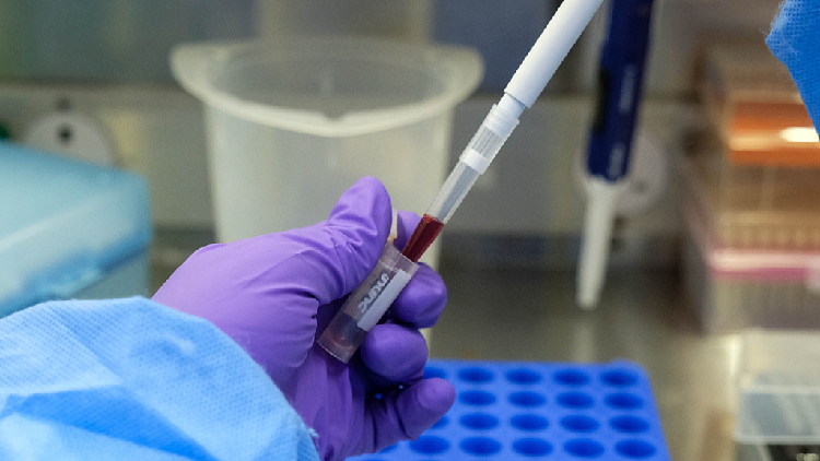 Uganda deploys health workers to DR Congo to support Ebola response