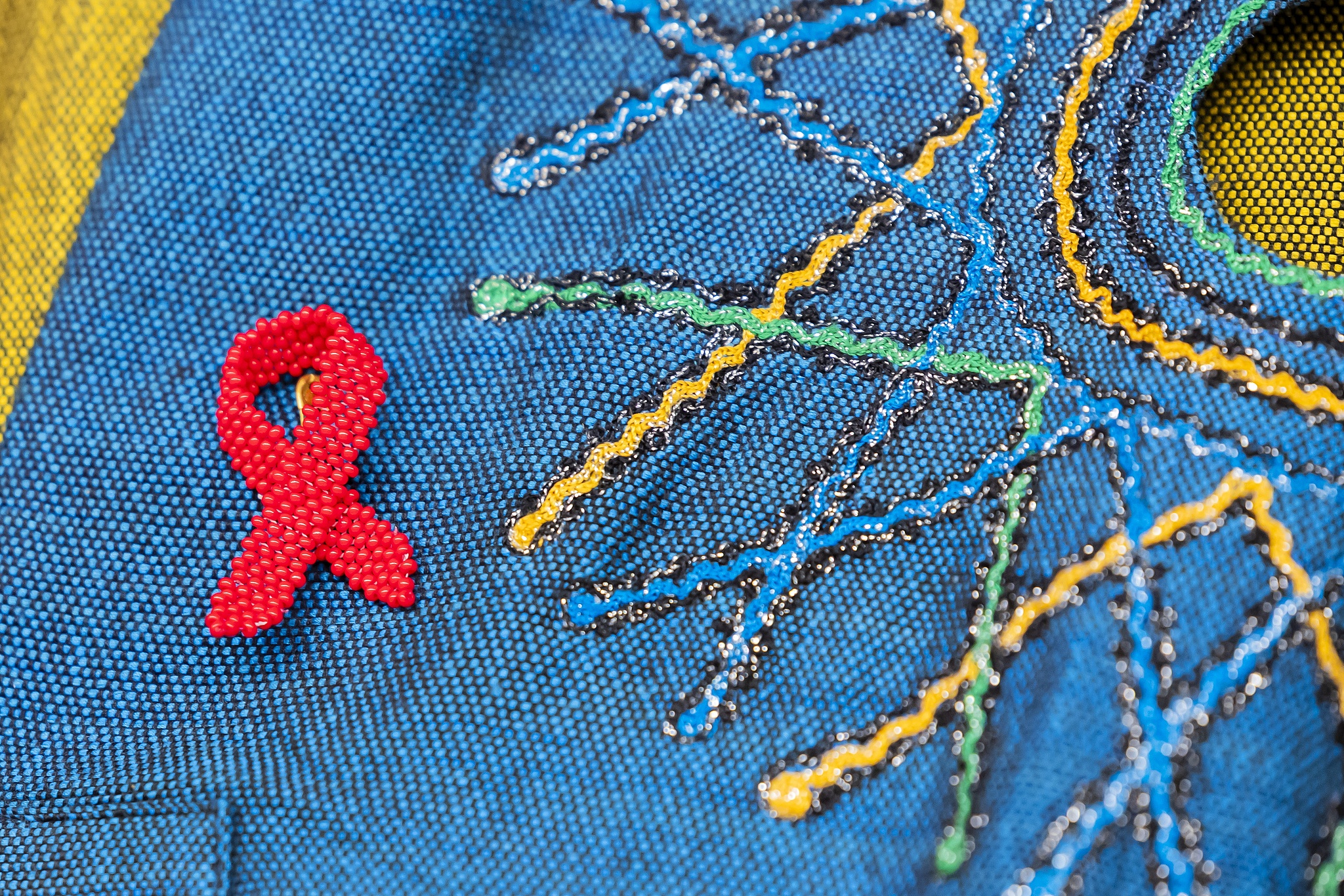 A red ribbon is the international symbol of the fight against HIV/AIDS and solidarity with people living with HIV. /CFP