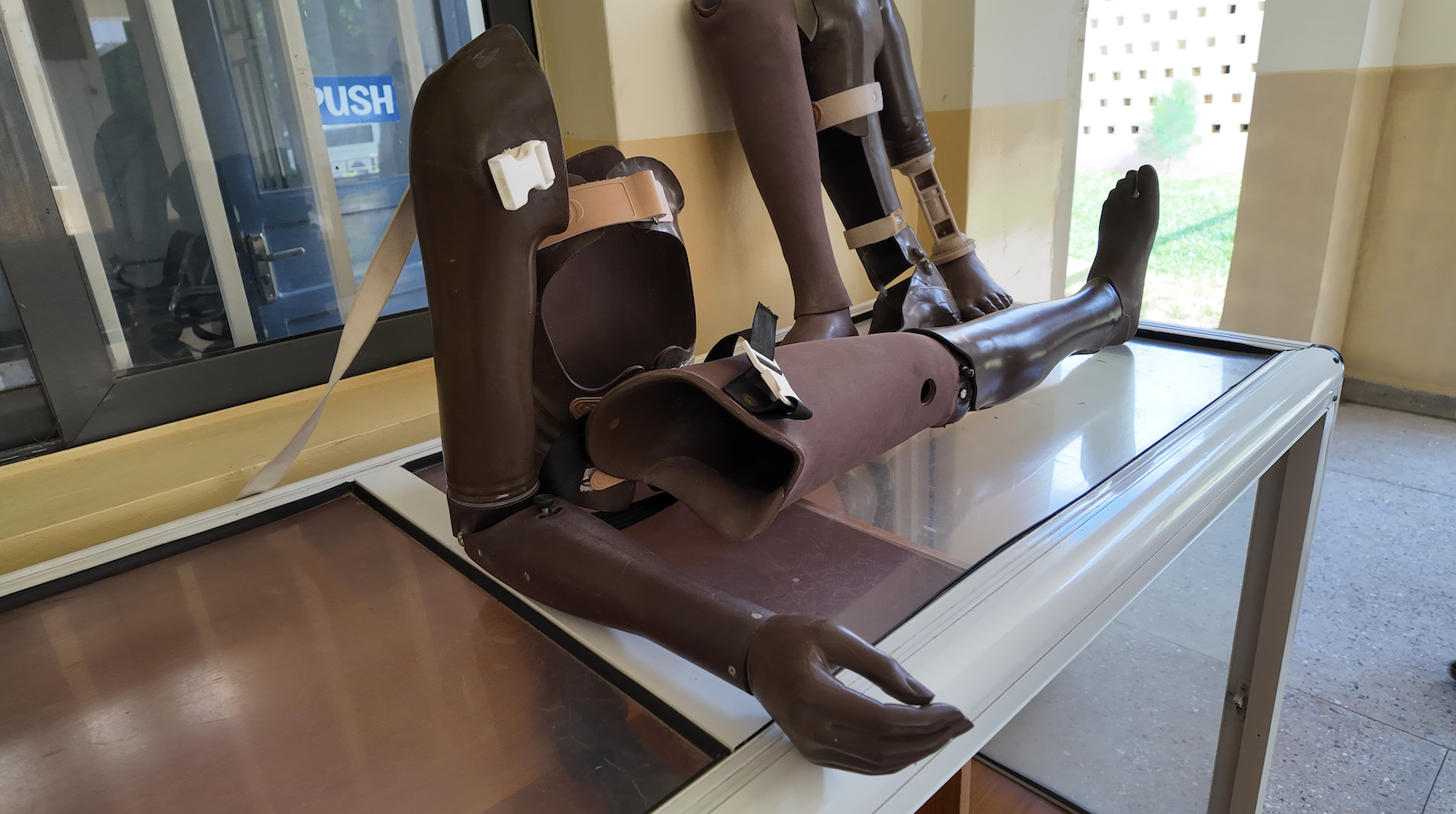 Samples of various prosthetic devices on display at the Physical Rehabilitation Centre at the University of Maiduguri Teaching Hospital in Maiduguri, Nigeria, on August 13, 2026. /David Mbewa/CGTN Africa